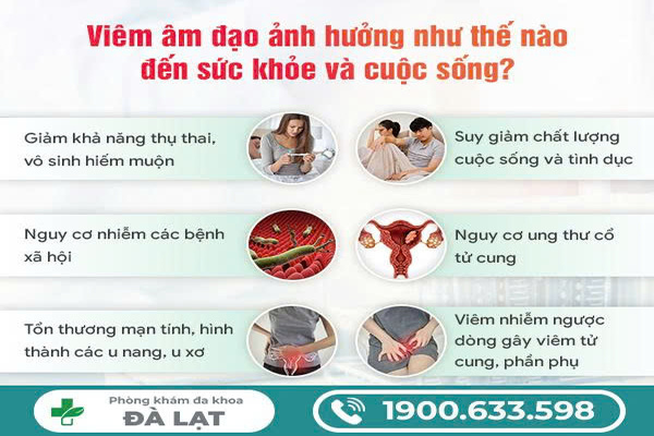 Hình ảnh minh họa